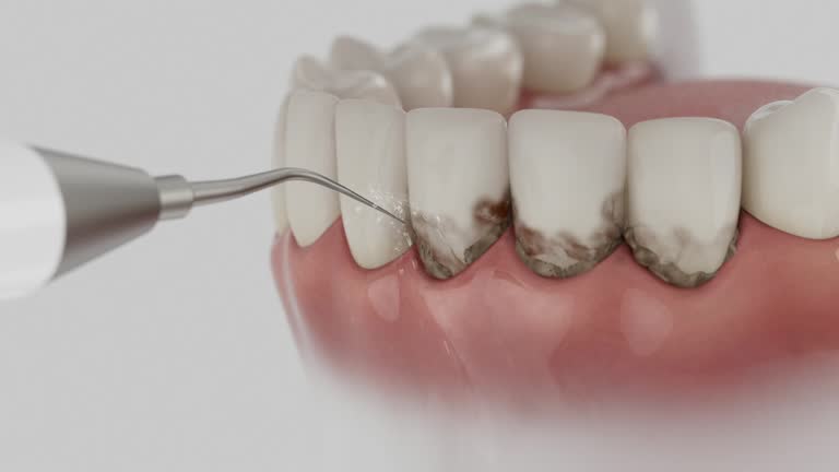 Reliable Dental Implants contractor in Colonial Heights, VA by Smile Center Dentistry